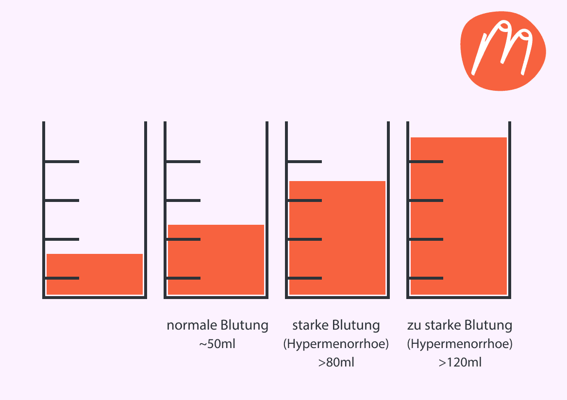 Hypermenorrhoe – wenn die Periode zu stark wird